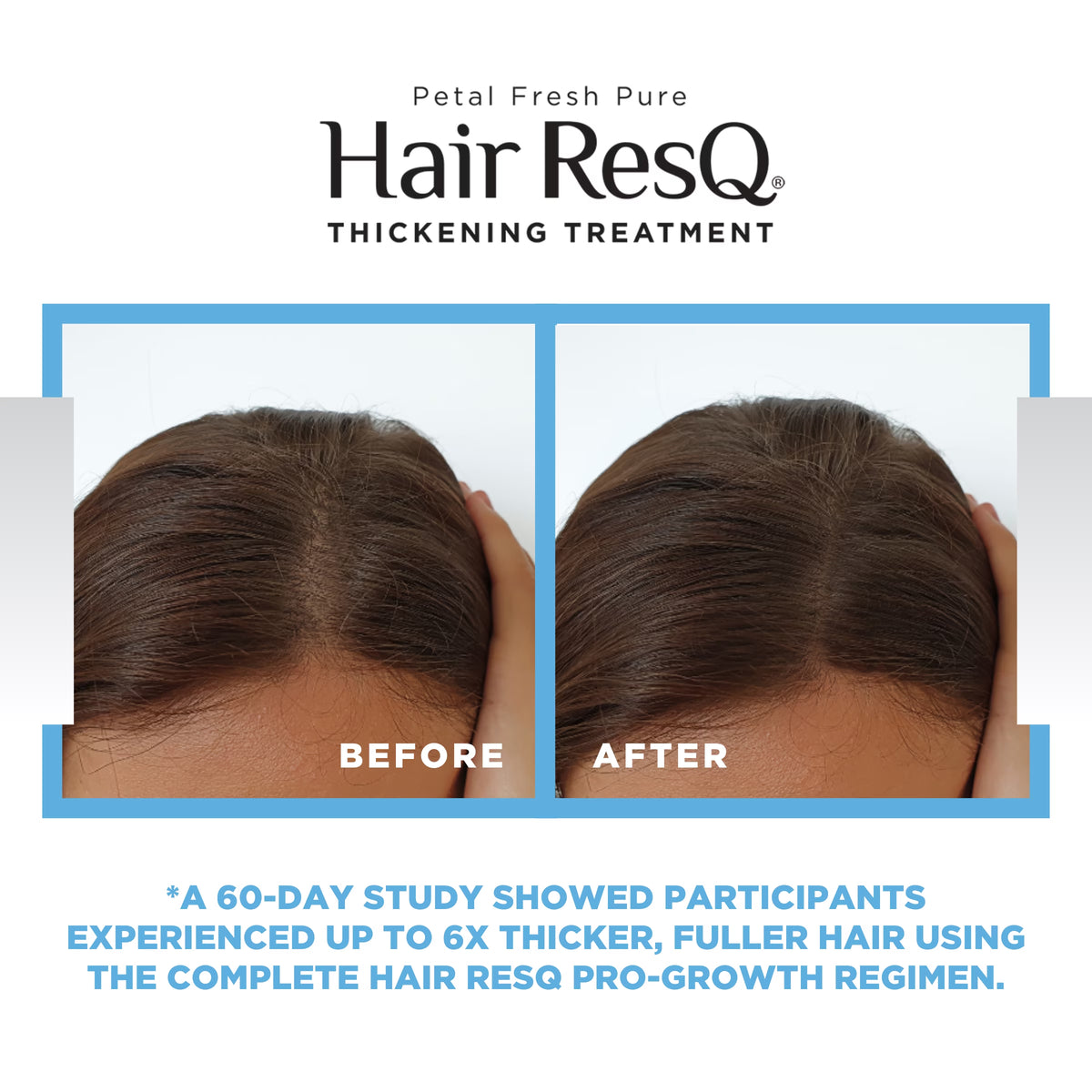 Hair Resq Thickening Shampoo, Advanced Biotin Pro-Growth Formula for All Hair Types, 12 Fl Oz